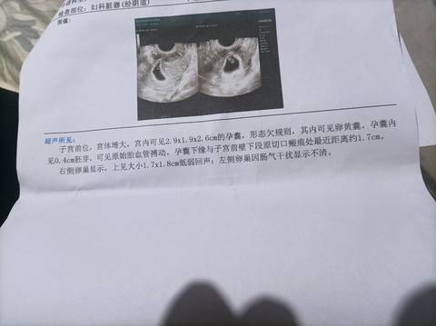 journal_insert_pic_1674332738