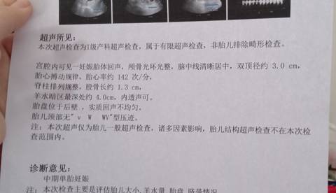 journal_insert_pic_1674054898