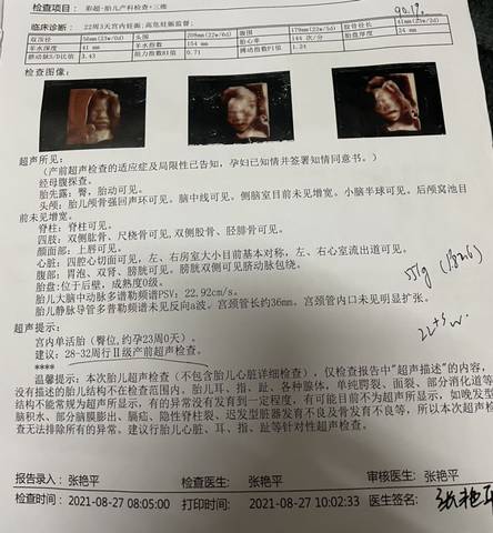 journal_insert_pic_1678051891