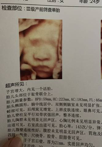 journal_insert_pic_1684333809
