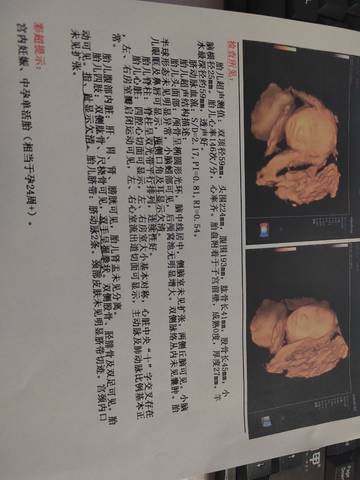 journal_insert_pic_1678538464