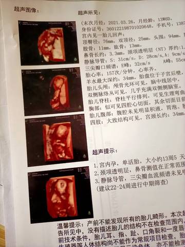 journal_insert_pic_1675805093