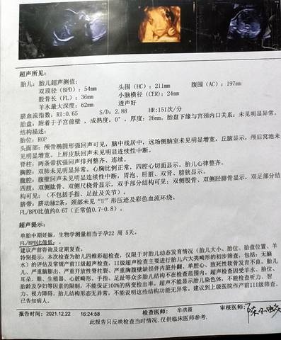 journal_insert_pic_1685476285