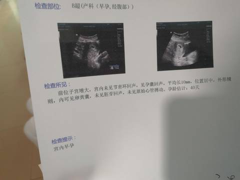 journal_insert_pic_1675469148