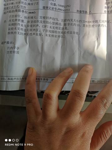 journal_insert_pic_1673455861