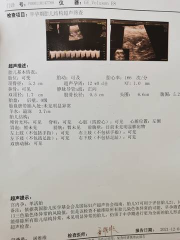journal_insert_pic_1673605126