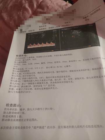 journal_insert_pic_1687550356