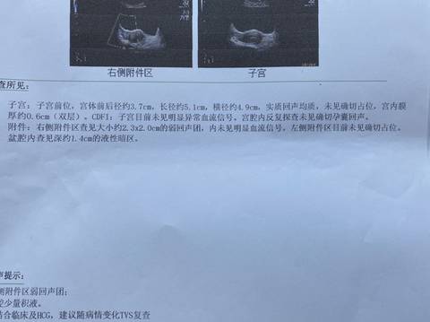 journal_insert_pic_1683686750