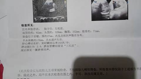 journal_insert_pic_1684920408