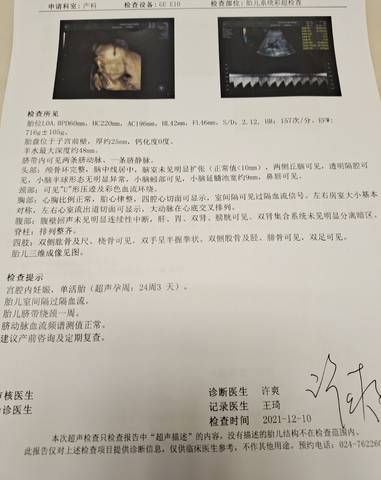 journal_insert_pic_1677341248