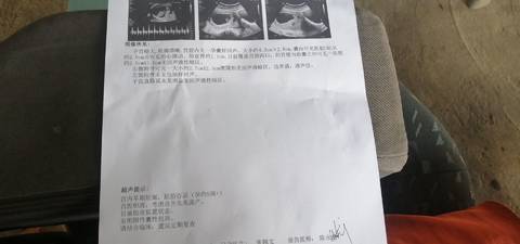 journal_insert_pic_1677786458