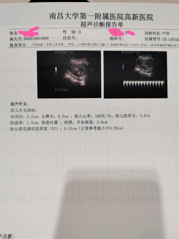 journal_insert_pic_1690088987
