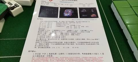 journal_insert_pic_1686086049