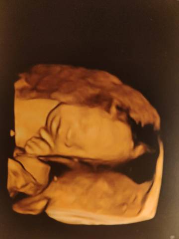 journal_insert_pic_1719368539