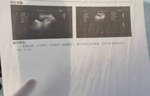 journal_insert_pic_1683256202