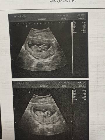 journal_insert_pic_1675676378