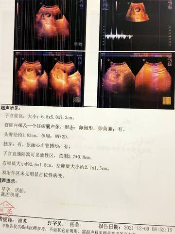 journal_insert_pic_1678062722