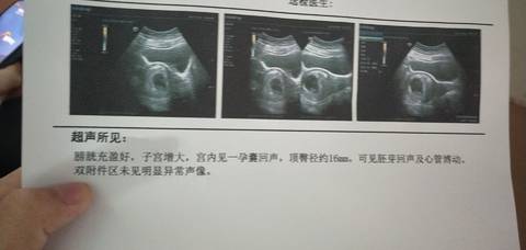 journal_insert_pic_1673517476