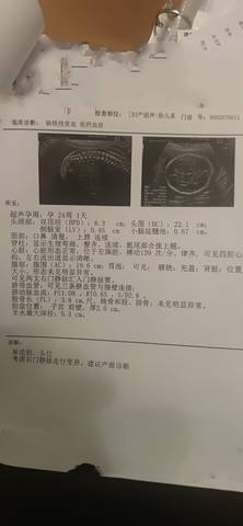 journal_insert_pic_1719849952