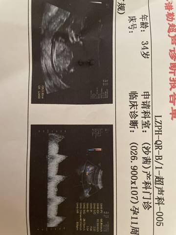 journal_insert_pic_1673444412