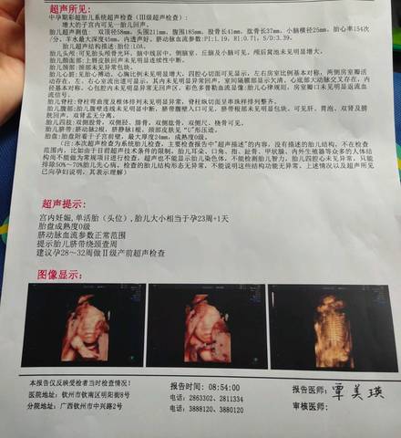journal_insert_pic_1683617563