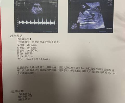 journal_insert_pic_1684495008