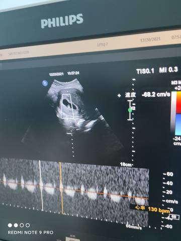 journal_insert_pic_1683108768