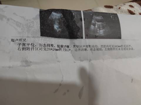 journal_insert_pic_1689700225