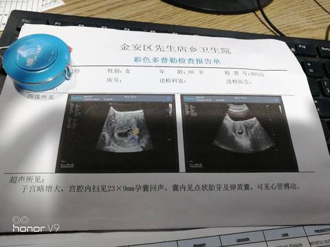 journal_insert_pic_1688800737