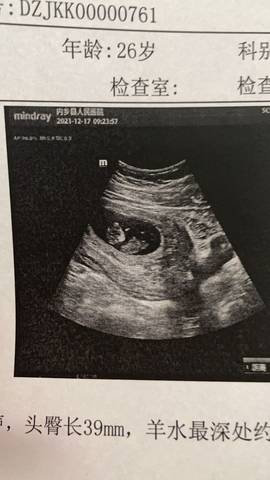 journal_insert_pic_1681354678