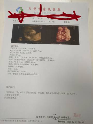 journal_insert_pic_1674767920