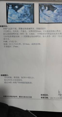 journal_insert_pic_1687157094
