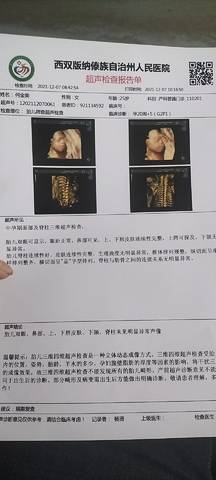 journal_insert_pic_1675495498