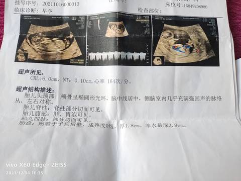 journal_insert_pic_1673571946