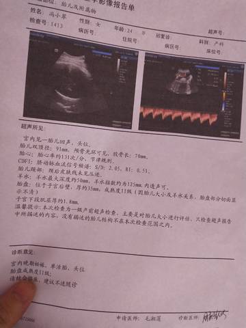 journal_insert_pic_1689574053