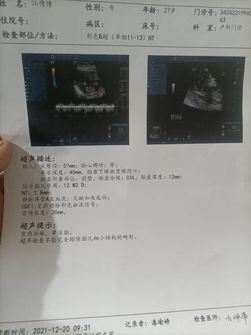 journal_insert_pic_1682929667