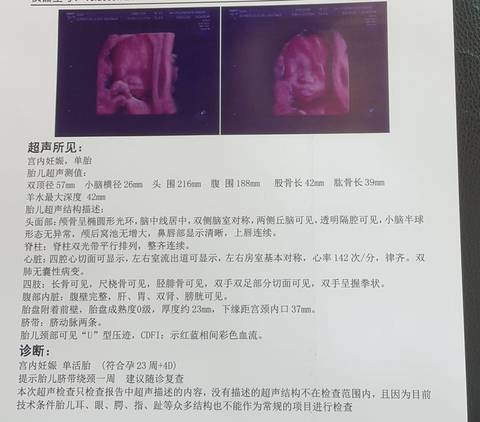 journal_insert_pic_1683471152
