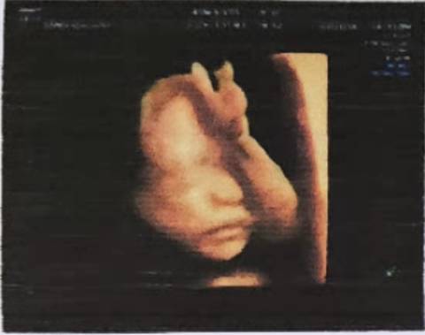 journal_insert_pic_1673288736