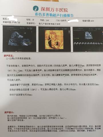 journal_insert_pic_1690049518