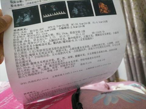 journal_insert_pic_1687427769