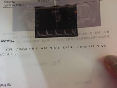 journal_insert_pic_1685955014