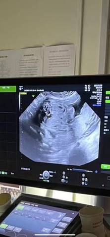 journal_insert_pic_1688156750