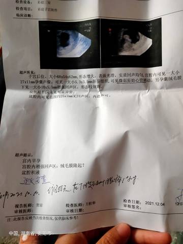 journal_insert_pic_1673727561