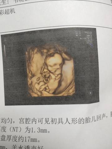 journal_insert_pic_1685439885