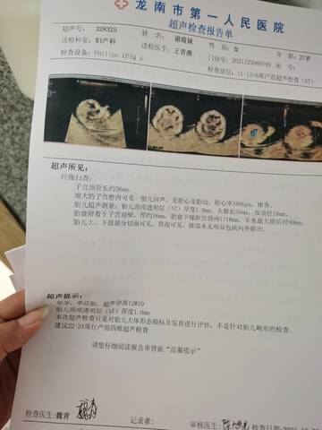 journal_insert_pic_1688932221