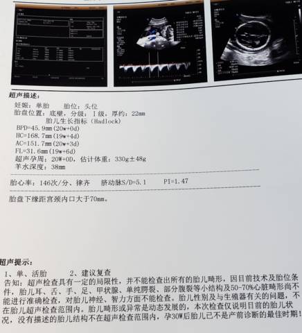 journal_insert_pic_1681582873
