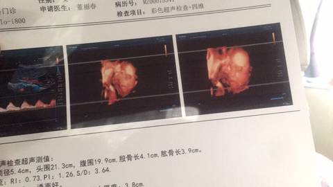 journal_insert_pic_1689023247