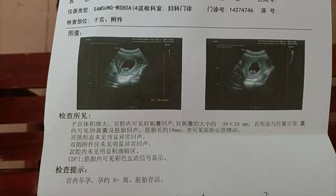 journal_insert_pic_1674797269