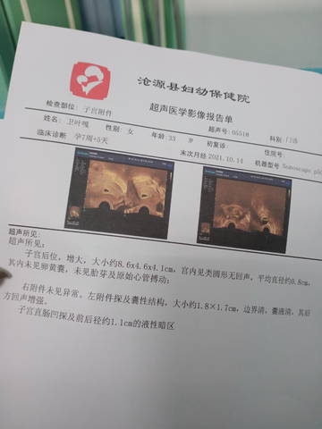 journal_insert_pic_1677589544