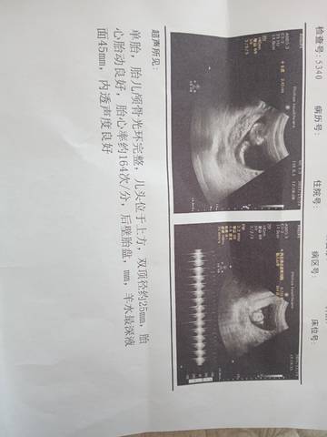 journal_insert_pic_1685243252